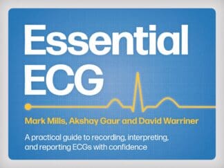 Essential ECG