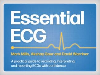 Essential ECG